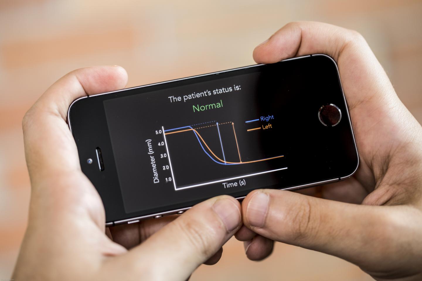 Smartphone App Assesses TBI at Site of Trauma