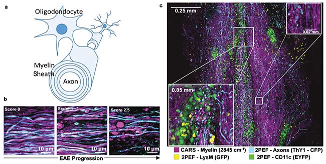 Polarization-Resolved CRS Reveals Lipid Disorder at the Molecular Scale