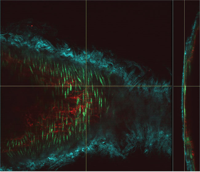 Lasers: A Unique Microscopy Source