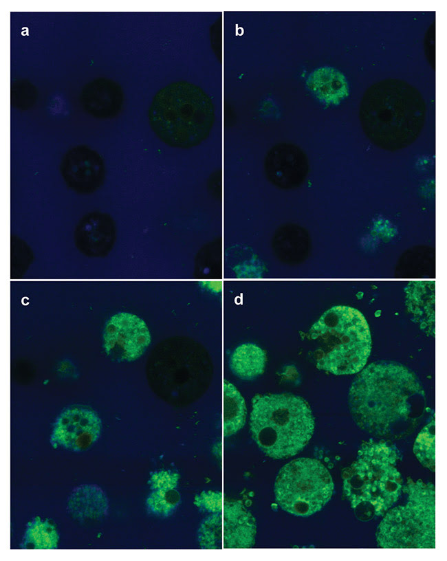 Figure 1. Amoeba cells incubated with curcumin and imaged with fluorescence microscopy under 450-nm excitation. The amoeba cells show a low native fluorescence (a), but when the curcumin is internalized, an intense green fluorescence can be seen (b and c). When the sample continues to be illuminated, the photodynamic reaction takes place. Main cell damage at the membranes results in cell death, mostly by cell membrane breakdown (d). Courtesy of Cristina Kurachi.