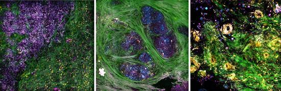 Label-Free System Images Molecular Features of Cancer Tissue in Real Time