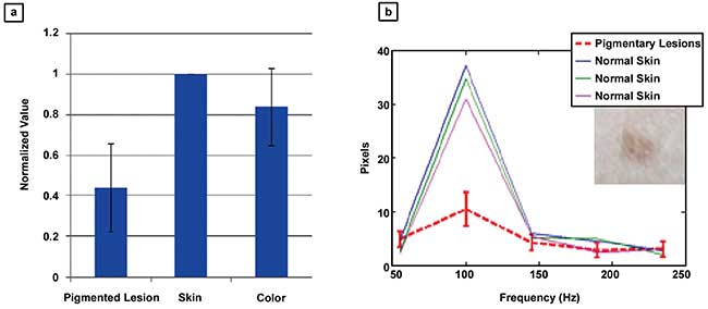 The average frequency responses of 20 different small pigmented lesions with respect to reference spots after calibration.