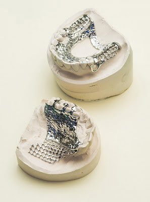 CoCr 3D printed removable partial dentures. Courtesy of Renishaw.