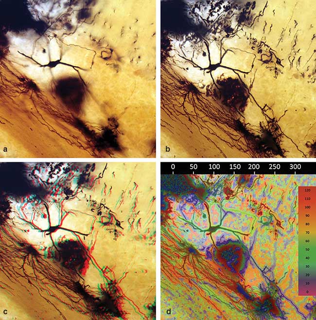 Nonconfocal 3D Microscopy Combines Real-Time Images with Depth of Focus