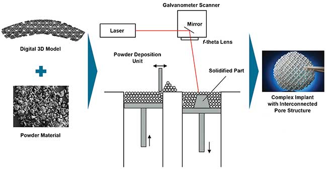 Schematic of laser sintering.