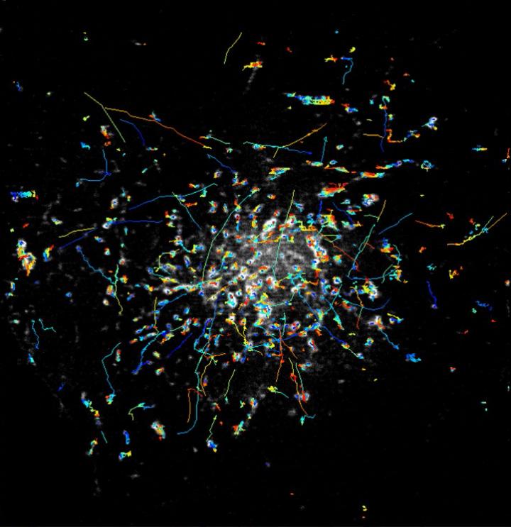 The rapid movements of Rab11 particles can be clearly imaged with the new instant TIRF-SIM microscope. Courtesy of Hari Shroff, National Institute of Biomedical Imaging and Bioengineering.