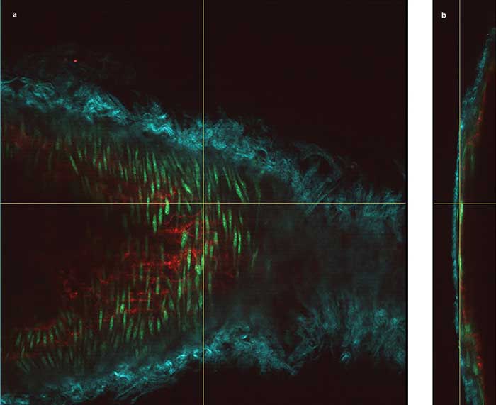 The vessel wall of a mouse carotid artery, showing en face