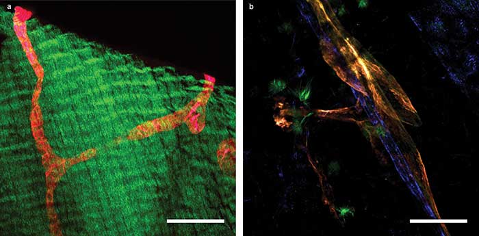 2P-LSM images of a transgenic mouse expressing the tdTomato protein under the control of a promoter that drives expression predominantly in lymphatic vessels.