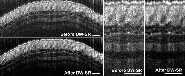Representative images of healthy mouse skin before and after dual window speckle reduction (DW-SR)