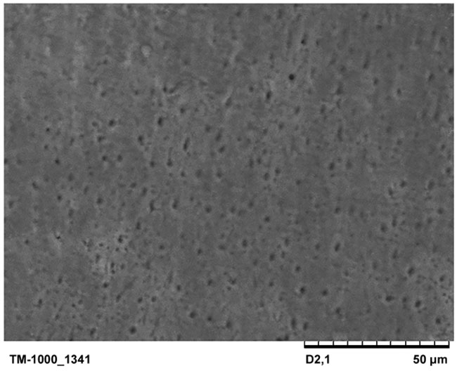 Imaging of the dentin surface using a scanning electron microscope after laser preparation.