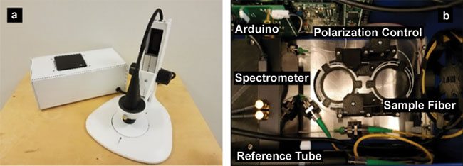 OCT Promising as Clear Point-of-Care Solution