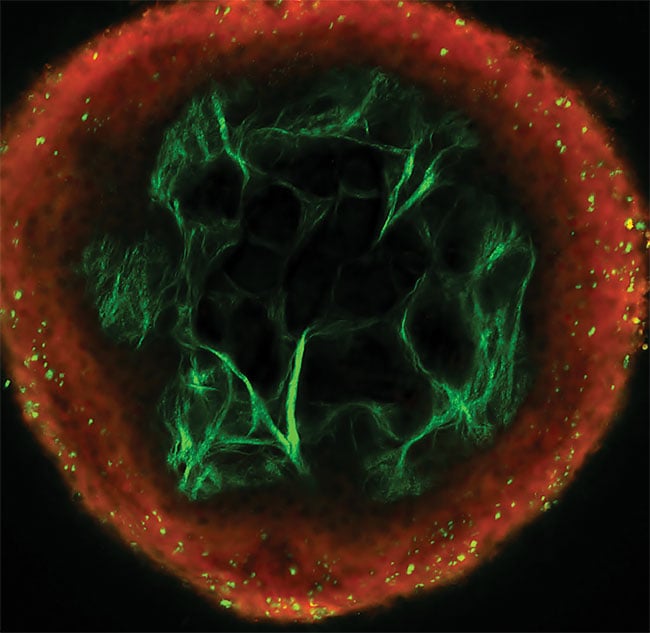 Collagen-rich dermis in chicken caruncle (500 × 500 µm)