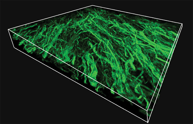 Collagen network in chicken heart tissue (250 × 250 × 36 µm). SHG microscopy captures the 3D organization of collagen fibers with submicron resolution. 