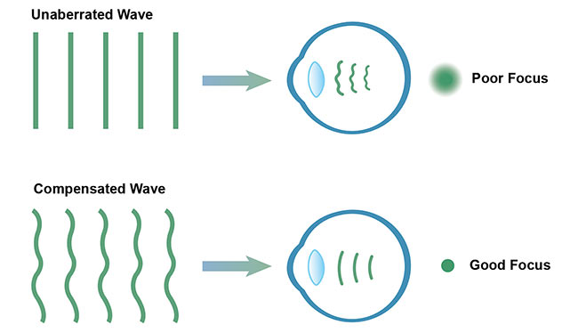 Figure 1. AO uses wavefront compensation to correct for naturally occurring aberrations in the eye, which improves the quality of focus for retinal imaging. Courtesy of Wasatch Photonics. 