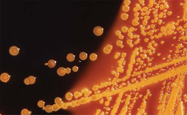 Figure 5. Colonies of Escherichia coli (E. coli) bacteria grown on a Hektoen enteric (HE) agar plate medium, as captured via hyperspectral imaging. Such colonies grown on HE agar display a characteristic, raised morphology, and are yellow to orange-yellow in color. Courtesy of the Centers for Disease Control and Prevention.