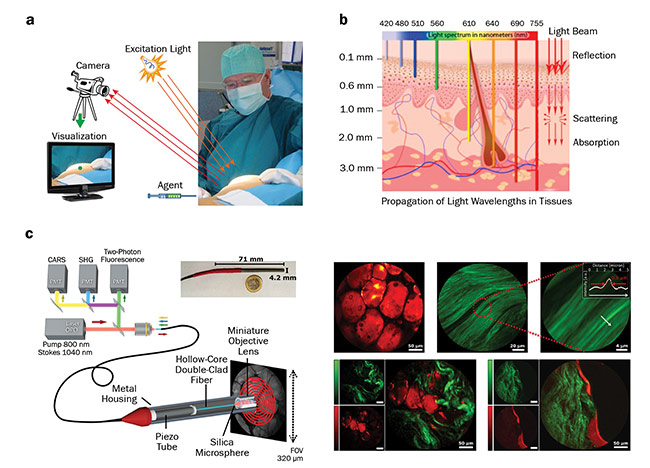 Medical Lasers Find Biophotonics Niche