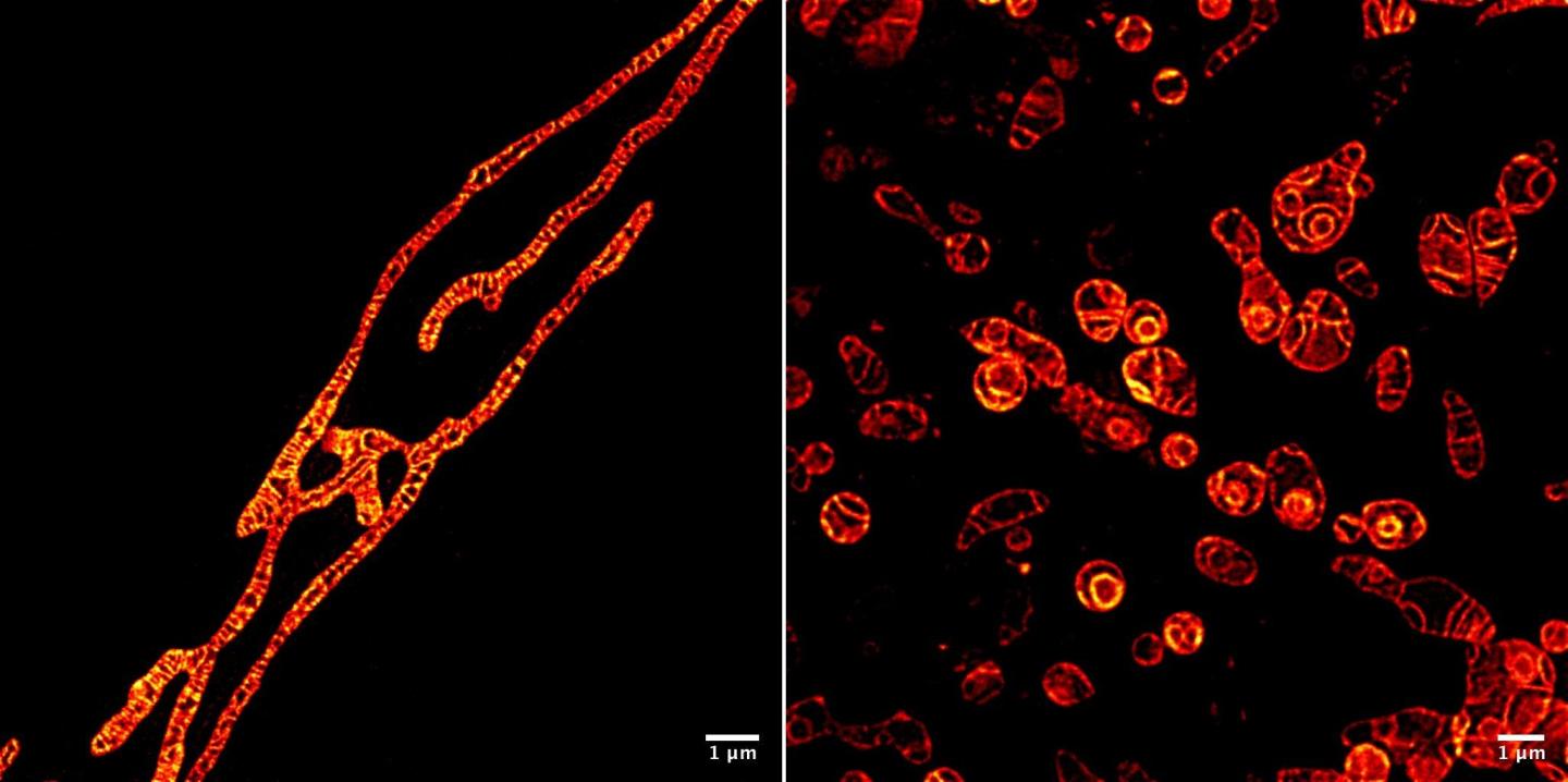 Inner membranes of live mitochondria under a STED microscope imaged using the MitoPB Yellow fluorescent marker molecule created by researchers at the Institute of Transformative Bio-Molecules (ITbM) at Nagoya University. 