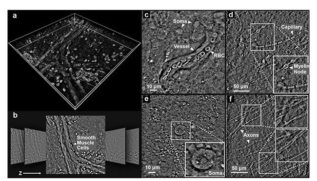 Figure 4. qOBM images from freshly excised but otherwise unaltered whole mouse brain. The 3D volumetric rendering of the brain using maximum intensity projection (a). Representative images from the stack (lateral dimensions: 250 × 250 µm) (b). qOBM images highlighting various cellular and subcellular structures (c-f). These images were taken 50 to 100 µm into the cortex. RBC: red blood cell. Reprinted with permission from Reference 8/The Optical Society (OSA).