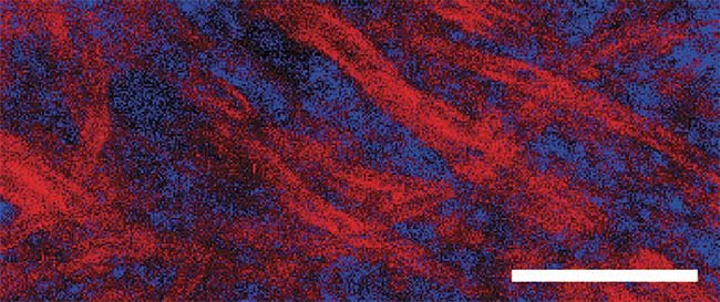  Figure 3. An example of compressive Raman bioimaging. Red represents lipid-rich regions, and blue represents protein-rich regions. The sample is a brain tissue with observable myelin stripes surrounding protein-rich regions. This image was taken in a few tens of seconds. Scale bar: 20 µm. Adapted with permission from Reference ?. 