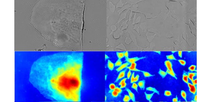 Quantitative phase images reveal more details than classical microscopy images. The KAUST technique captures both bright-field images (top) and phase images (bottom) in a single measurement. Courtesy of KAUST.