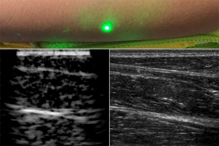 Noncontact Laser Ultrasound Safely Images Human Tissue