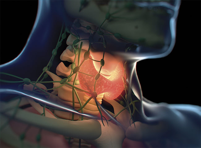 Raman Spectral Cytology Helps Diagnose Thyroid Cancer