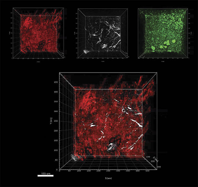  Figure 3. Murine lymph node z-stack images where z = 300 µm using a Coherent Monaco Opera-F combination tuned to a wavelength of 1630 nm, and a LaVision TriM Scope microscope. Three-photon excitation of tdTomato detected at 595 (±20) nm (red); SHG signals from collagen fibers detected at 810 (±45) nm (white); and THG of lipid bilayers, lipids, or other anisotropic structures detected at 525 (±25) nm (green). Combined tdTomato and SHG signals (composite). Courtesy of Niesner lab. 