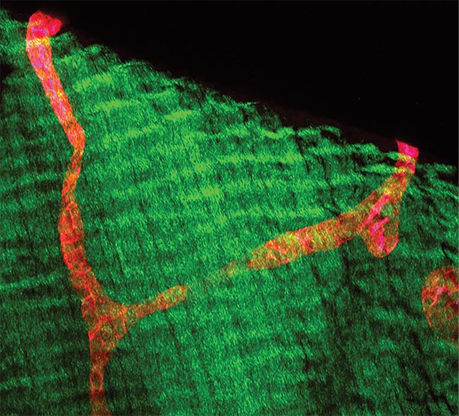 VEGFR3-positive (red) lymphatic vessels in diaphragm whole-mount section. Collagen fibers were visualized by second-harmonic generation (SHG) (green). Scale bar = 100 µm. Courtesy of Friedemann Kiefer, European Institute for Molecular Imaging.