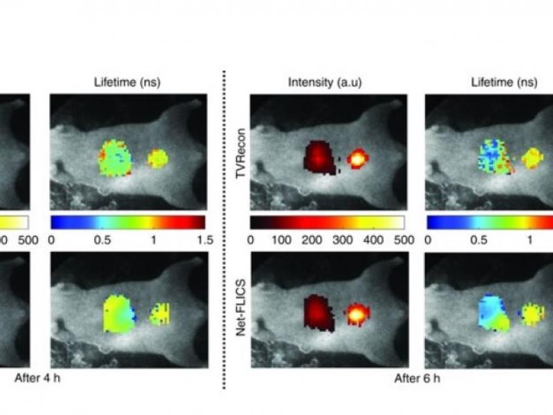 New Technique Uses Deep Learning to Speed Molecular Imaging