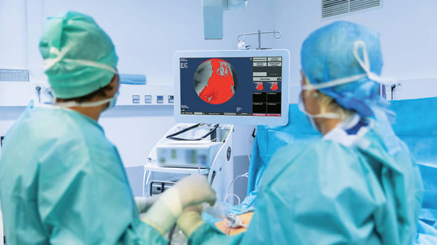 The Lumicell System features an investigational onco-fluorescent agent and a handheld imaging device that enable cancer surgeons to see and remove cancer cells in real-time during operations. (Courtesy of Sylvain Sonnet)