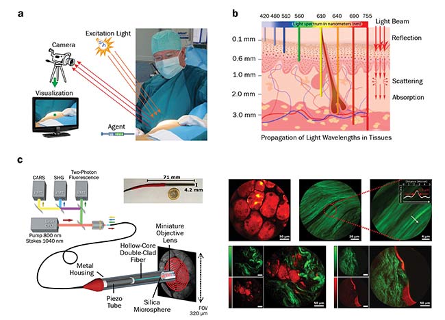 Figure 1. Use of optical imaging during surgery. The imaging system requires a light source, a detector or a camera, and a visualization system. A special agent is applied prior to imaging (a). Penetration depth of different wavelengths of light into the skin, and the light interactions within the tissue (b). Schematic of a multimode imaging system integrated in an endoscopic device (c, left); false-colored images of the human tissue, with fat highlighted in red and collagen in green (c, right). PMT: photomultiplier tube; CARS: coherent anti-Stokes Raman scattering; SHG: second-harmonic generation; OPO: optical parametric oscillator. Image a: courtesy of Leiden University Medical Center; b: courtesy of the University of Liège; c: adapted from Light: Science & Applications, https://doi.org/10.1038/s41377-018-0003-3.