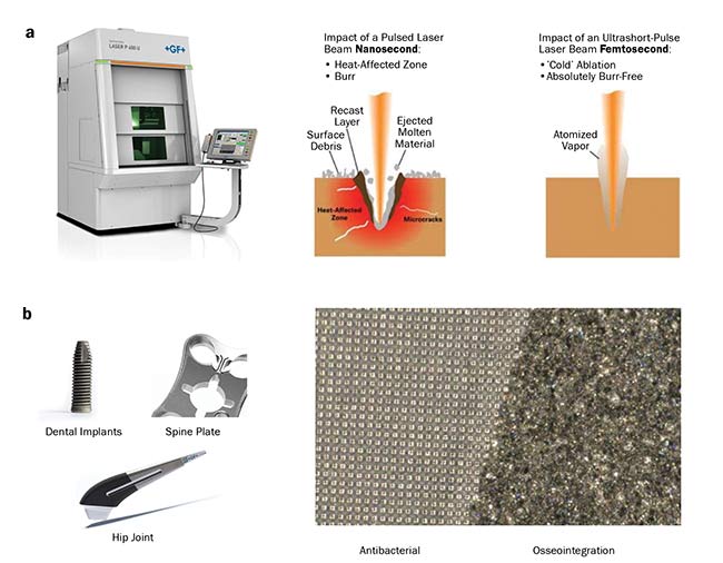 Figure 4. Laser-based texturing machinery (a, left) and a comparison of the impact of the laser beam of different lengths on the material surface (a, right). Possible applications of laser texturing for clinical use (b). Courtesy of Microrelleus SL.
