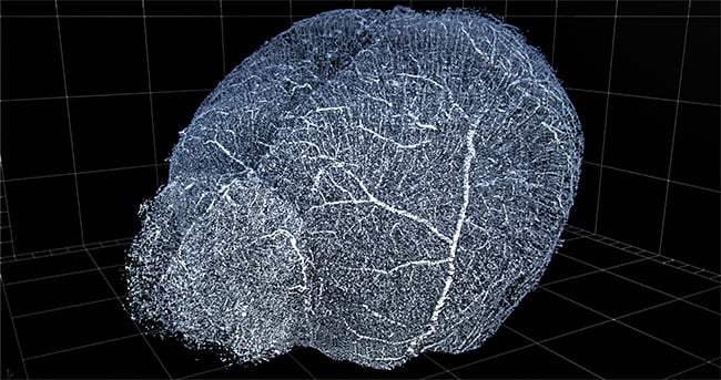 Computational imaging and automation enable 3D reconstruction of vasculature for viewing and extraction of statistics. Shown here is a 3D reconstruction of mouse brain vasculature. Courtesy of 3Scan.