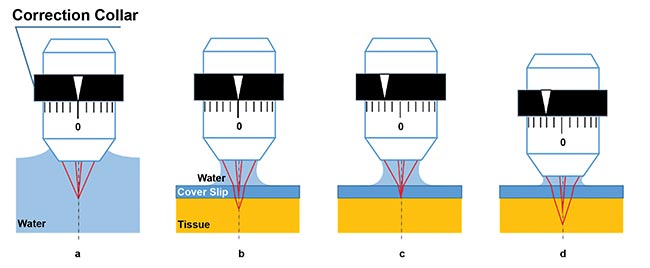 Figure 1. Schematic figures of spherical aberration caused by cover glass or tissue, and the effect of correction collar adjustment. Ideal focus happens when a water-dipping objective is immersed in water; paraxial and peripheral light rays focus to the same point. There is no spherical aberration (a). Focus with spherical aberration: When the surface of tissue is observed under a cover of glass with water immersion, refraction occurs at the boundaries between water, glass, and tissue, which causes spherical aberration (b). Spherical aberration is compensated by adjusting the correction collar (c). With the correction collar still at the previous setting, as in c, spherical aberration occurs again when the focal plane is moved to a deeper position within the sample (d). Courtesy of Hiromu Monai, Hajime Hirase, and Atsushi Miyawaki/RIKEN BSI-Olympus.