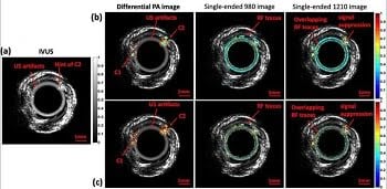 Figure 11: (a) Normalized 14-MHz IVUS image of the atherosclerotic artery phantom by IVUS at 14-MHz. (b) Normalized PAR amplitude and (c) phase images of IV-DPAR, single-ended 980-nm PAR and singleended 1210-nm PAR modes. The same endoscopic transducer and instrumentation were shared by IVUS and IV-DPAR for coregistration. C1, Cholesterol sample 1 and C2, Cholesterol sample 2. Courtesy of SUNG SOO SEAN CHOI ET AL.