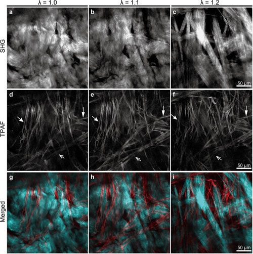 Multiphoton Microscopy Uncovers the Architecture of Collagen and Elastic Fibers