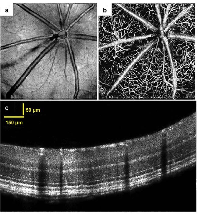 Figure 2. VIS-OCT retinal imaging in mouse. En face fundus image (a). Microangiogram by VIS-OCT (b). A high-definition B-scan image showing all the fine details of the retinal layers (c). Reprinted and adapted from Reference 5.