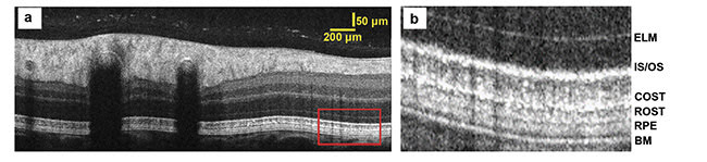 Figure 3. VIS-OCT B-scan image of human retina. ELM: external limiting membrane. Courtesy of Ian Rubinoff/Northwestern University.