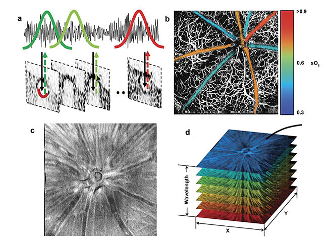 Figure 4. Method to extract sO2 from single retinal vessels (a). Pseudo-colored sO2 map overlaid on VIS-OCT angiogram (b). En face image of segmented RNFL/GCL (c). Spectroscopic VIS-OCT image stack (d). Images (a) and (c) adapted from Reference 3; (b) adapted from Reference 5; (d) adapted from Reference 9.