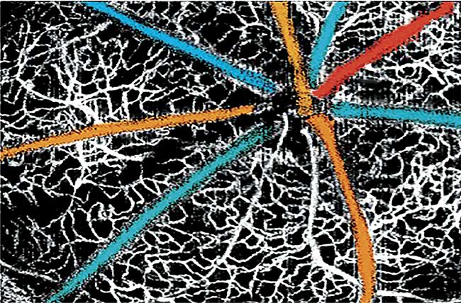 A multicolored retinal blood oxygen saturation map overlaid on a VIS-OCT angiogram. Adapted from Reference 5.