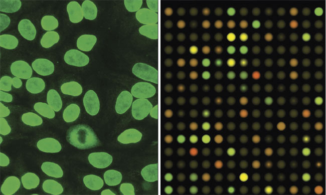  Figure 9. Immunofluorescence microscopic assay in autoimmune diagnostics (left). A DNA micro- array used in cancer and other disease research (right). Courtesy of Basler AG.