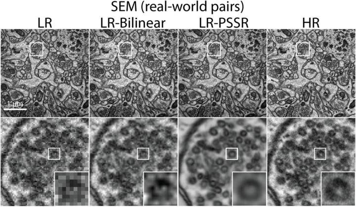 3D imaging of brain using deep learning techniques, Salk Institute, UT Austin.