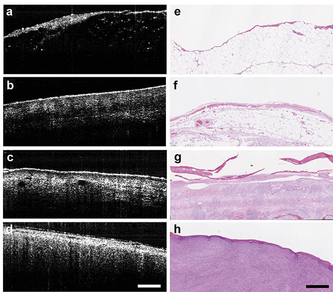 Figure 3. With the aid of an OCT system, tissue is differentiated between fat (a, e); muscle (b, f); skin (c, g); and sarcoma (d, h). Courtesy of Laura Selmic.