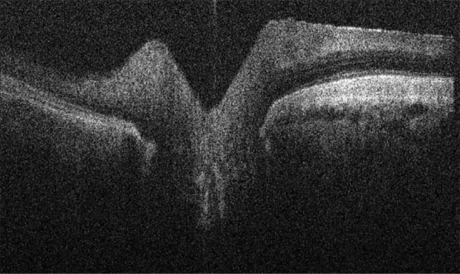 Figure 2. An OCT image of a horse retina. Courtesy of OcuScience.