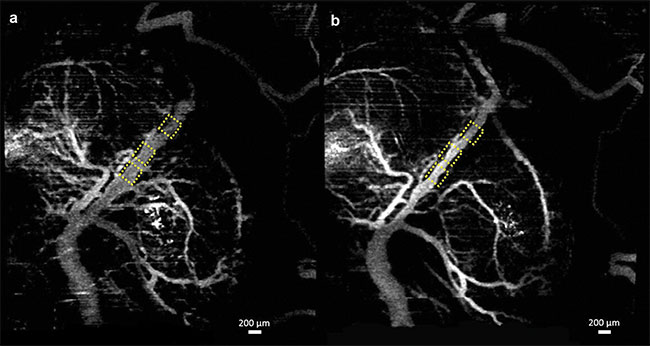 Figure 1. Vasculature changes in the embryonic brain before (a) and 45 min after (b) maternal exposure to ethanol. Adapted with permission from Reference 10.