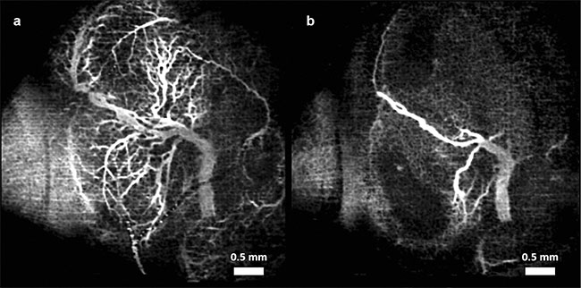 Figure 2. Vasculature changes in the embryonic brain before (a) and 45 min after (b) maternal exposure to nicotine. Adapted with permission from Reference 11.