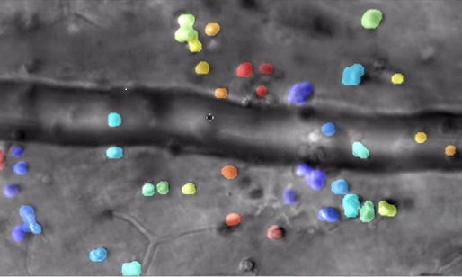 Microscopy, Infrared Videography, AI Capture Immune Cell Interactions in Eye