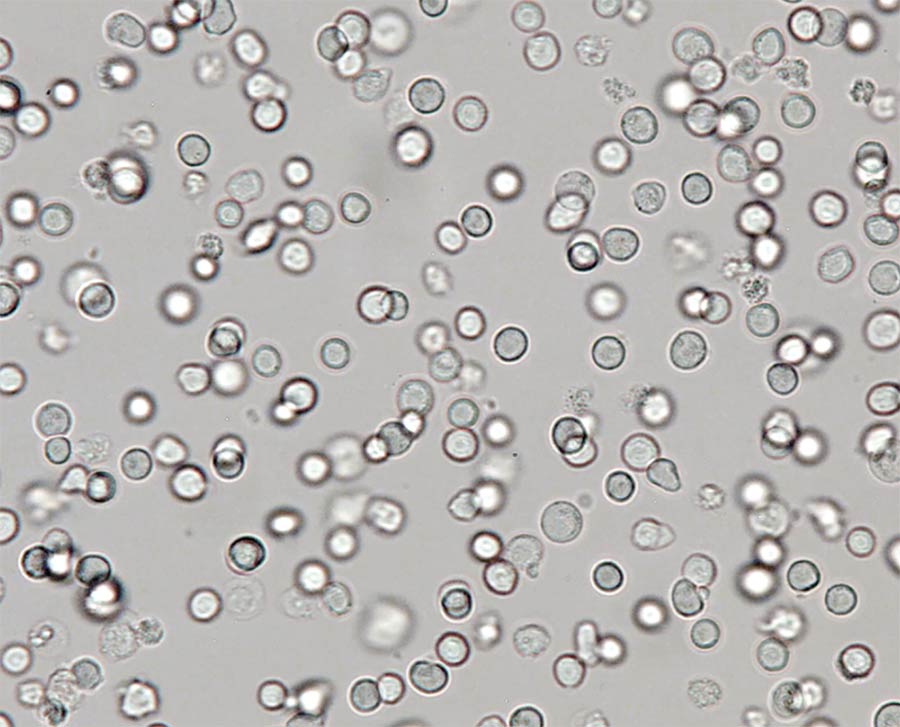 A high-speed camera and frame grabbers produce clear pictures that can be used to detect cancer or other diseases in blood cells. Courtesy of Vision Research Ametek