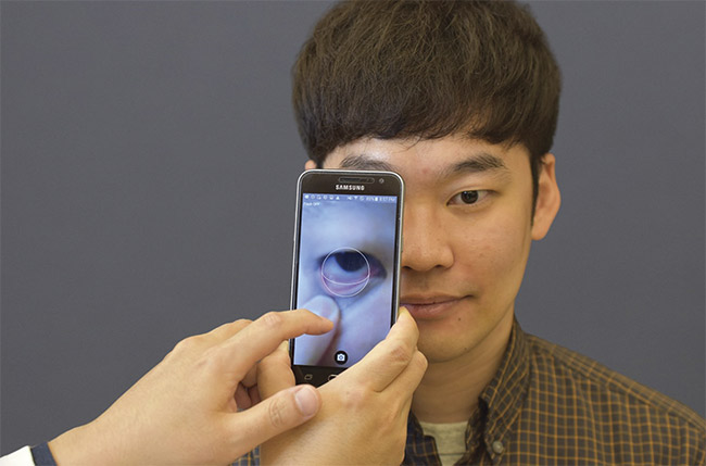 Figure 1. The mobile health (mHealth) application for noninvasive blood hemoglobin quantification. The easily accessible inner eyelid (palpebral conjunctiva) is used as a sensing site. Courtesy of Sang Mok Park and Young Kim.