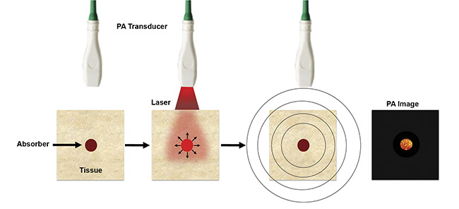 Figure 1. An illustration of photoacoustic (PA) imaging. Adapted with permission from Reference 5.
